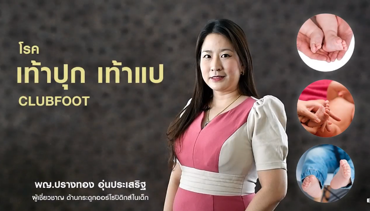 การรักษา “เท้าปุก เท้าแป” ซึ่งพบได้ในเด็ก